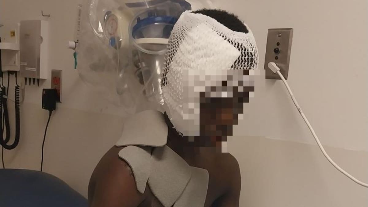 Un enfant avec des pansements, sur un lit d'hôpital.